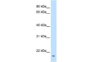 FAM107A antibody used at 0. (FAM107A anticorps  (Middle Region))