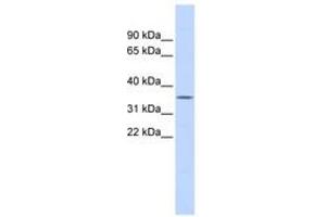 Image no. 1 for anti-Ficolin (Collagen/fibrinogen Domain Containing) 1 (FCN1) (AA 180-229) antibody (ABIN6743782) (FCN1 anticorps  (AA 180-229))