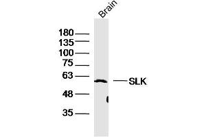 Mouse Brain lysates probed with SLK Polyclonal Antibody, Unconjugated  at 1:300 dilution and 4˚C overnight incubation. (SLK anticorps  (AA 165-270))