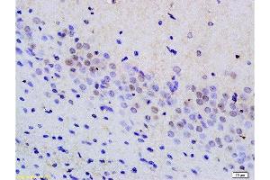 Formalin-fixed and paraffin embedded rat brain tissue labeled with Anti phospho-MAP3K9+MAP3K10(Thr312+Thr266) Polyclonal Antibody, Unconjugated  at 1:200 followed by conjugation to the secondary antibody and DAB staining (MAP3K9 anticorps  (pThr312))