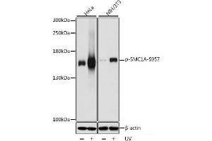 Western blot analysis of extracts of various cell lines using Phospho-SMC1A(S957) Polyclonal Antibody at dilution of 1:1000. (SMC1A anticorps  (pSer957))