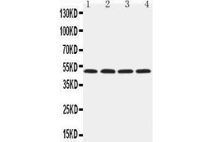 Anti-HYAL1 antibody,  Western blotting Lane 1: NRK Cell Lysate Lane 2: Mouse Liver Tissue Lysate Lane 3: Mouse Kidney Tissue Lysate Lane 4: SP2/0 Cell Lysate
