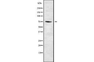 Western blot analysis of PAK6 using HUVEC whole cell lysates