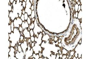 IHC analysis of Caveolin-2/CAV2 using anti Caveolin-2/CAV2 antibody (ABIN7601170). (Caveolin 2 anticorps  (AA 3-162))