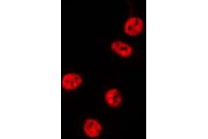ABIN6275508 staining MCF7 by IF/ICC. (RCL1 anticorps  (C-Term))