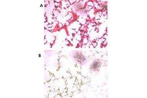 (A) H&E staining of frozen human ovarian cancer tissue with UCH37 antibody at 1:250. (UCHL5 anticorps  (AA 56-87))