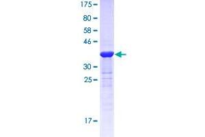 Growth Differentiation Factor 5 (GDF5) (AA 28-127) protein (GST tag)