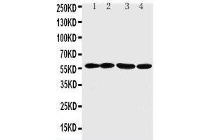 Anti-ANGPTL1 antibody, Western blotting Lane 1: A549 Cell Lysate Lane 2: SW620 Cell Lysate Lane 3: MCF-7 Cell Lysate Lane 4: MM231 Cell Lysate (ANGPTL1 anticorps  (C-Term))