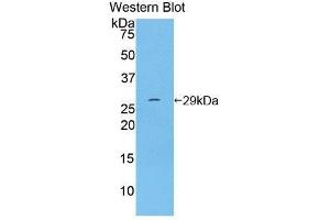Western Blotting (WB) image for anti-Integrin alpha D (ITGAD) (AA 879-1099) antibody (ABIN1859491) (ITGAD anticorps  (AA 879-1099))