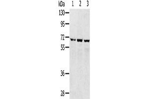 Gel: 8 % SDS-PAGE, Lysate: 40 μg, Lane 1-3: 293T cells, hepg2 cells, A172 cells, Primary antibody: ABIN7192509(SLC5A9 Antibody) at dilution 1/300, Secondary antibody: Goat anti rabbit IgG at 1/8000 dilution, Exposure time: 1 minute (SLC5A9 anticorps)