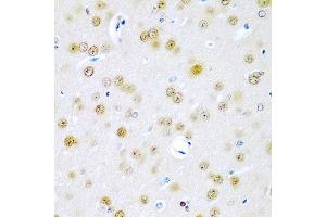 Immunohistochemistry of paraffin-embedded rat brain using TUSC2 antibody at dilution of 1:200 (40x lens). (TUSC2 anticorps)