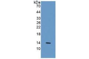 WB of Protein Standard: different control antibodies  against Highly purified E. (IL-33 Kit ELISA)
