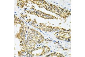 Immunohistochemistry of paraffin-embedded human prostate using HLA-DQA1 antibody. (HLA-DQA1 anticorps  (AA 24-216))