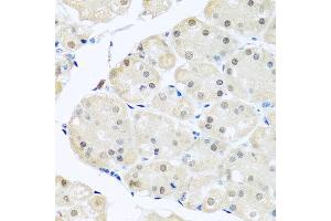 Immunohistochemistry of paraffin-embedded human stomach using DNAL1 antibody at dilution of 1:100 (x40 lens). (DNAL1 anticorps)