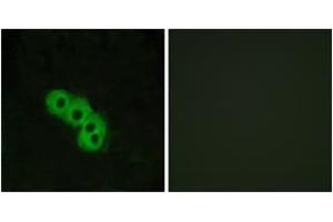 Immunofluorescence (IF) image for anti-Niacin Receptor (PUMAG/NIACR1/NIACR2) (AA 285-334) antibody (ABIN2890788) (Niacin Receptor (PUMAG/NIACR1/NIACR2) (AA 285-334) anticorps)