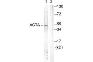 Western blot analysis of extracts from mouse brain cells, using Actin-pan ( alpha/gamma)  (Ab-55/53) Antibody. (Actin anticorps  (AA 21-70))