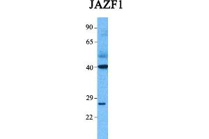 Host:  Rabbit  Target Name:  JAZF1  Sample Tissue:  Human Lung Tumor  Antibody Dilution:  1.