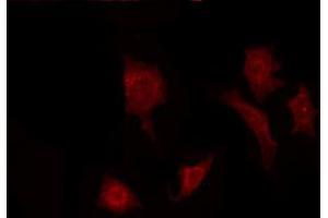 ABIN6272299 staining Hela by IF/ICC.