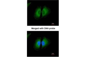 ICC/IF Image Immunofluorescence analysis of paraformaldehyde-fixed HeLa, using Kininogen-1, antibody at 1:200 dilution.