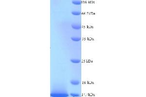SDS-PAGE (SDS) image for S100 Calcium Binding Protein B (S100B) (AA 2-92) protein (His tag) (ABIN7691137)