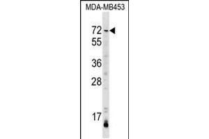 Western blot analysis in MDA-MB453 cell line lysates (35ug/lane). (AMIGO3 anticorps  (AA 242-268))