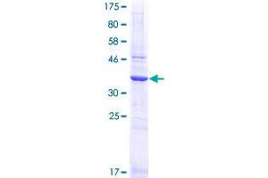 Image no. 1 for Transcription Elongation Factor B (SIII), Polypeptide 1 (15kDa, Elongin C) (TCEB1) (AA 1-112) protein (GST tag) (ABIN1322346)