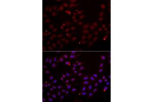 Immunofluorescence analysis of HeLa cells using CST2 antibody (ABIN5973947). (CST2 anticorps)