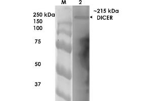 Western Blot analysis of Rat Brain Membrane showing detection of ~215 kDa Dicer protein using Mouse Anti-Dicer Monoclonal Antibody, Clone S167-7 . (DICER1 anticorps  (AA 1638-1899) (Atto 488))
