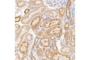 Immunohistochemistry of paraffin-embedded rat kidney using MMP14/MT1-MMP Rabbit pAb (ABIN3023354, ABIN3023355, ABIN3023356 and ABIN6219646) at dilution of 1:100 (40x lens). (MMP14 anticorps)