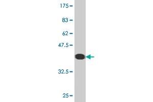 Western Blot detection against Immunogen (36. (FHL1 anticorps  (AA 23-120))