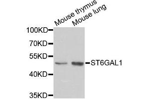 Western blot analysis of extracts of various cell lines, using ST6GAL1 antibody (ABIN5973377) at 1/1000 dilution. (ST6GAL1 anticorps)