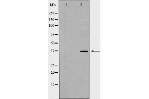 Western blot analysis of Jurkat whole cell lysates, using ACP5 Antibody. (ACP5 anticorps  (N-Term))