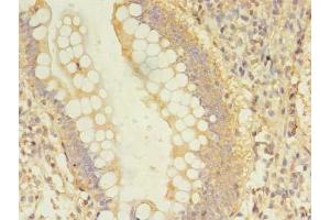 Immunohistochemistry of paraffin-embedded human small intestine tissue using ABIN7150805 at dilution of 1:100 (Dynamitin anticorps  (AA 1-252))