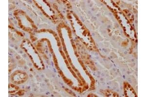 IHC image of ABIN7127532 diluted at 1:100 and staining in paraffin-embedded human kidney tissue performed on a Leica BondTM system. (Recombinant GSTP1 anticorps)