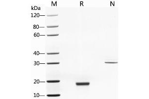 2 μg of M-CSF, Human was resolved with SDS-PAGE under reducing (R) and non-reducing (N) conditions and visualized by Coomassie Blue staining.