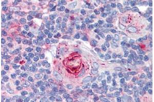 Human Thymus (formalin-fixed, paraffin-embedded) stained with ICAM1 antibody ABIN298517 at 10 ug/ml followed by biotinylated anti-mouse IgG secondary antibody ABIN481714, alkaline phosphatase-streptavidin and chromogen. (ICAM1 anticorps)