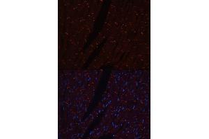 Immunofluorescence analysis of rat heart using N-Cadherin antibody (ABIN3017242, ABIN3017243, ABIN3017244 and ABIN6220011).
