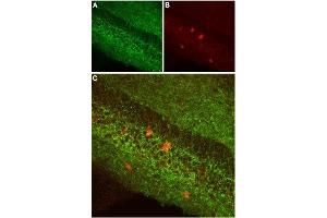 Expression of CB1 receptor in mouse hippocampus - Immunohistochemical staining of mouse hippocampus using Anti-Cannabinoid Receptor 1 (extracellular) Antibody (ABIN7043023, ABIN7044155 and ABIN7044156), (1:100). (CNR1 anticorps  (Extracellular, N-Term))