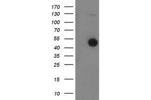 Western Blotting (WB) image for anti-Beclin 1, Autophagy Related (BECN1) antibody (ABIN1496868)