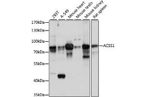 Western blot analysis of extracts of various cell lines, using  antibody (ABIN7265426) at 1:1000 dilution. (ACSS1 anticorps  (AA 340-689))