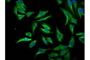 Immunofluorescence staining of Hela Cells with ABIN7127560 at 1:50, counter-stained with DAPI. (Recombinant ID1 anticorps)