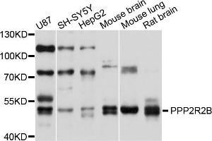 Western blot analysis of extracts of various cells, using PPP2R2B antibody. (PPP2R2B anticorps)