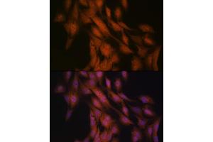 Immunofluorescence analysis of C6 cells using Gli3 Rabbit mAb (ABIN7267385) at dilution of 1:100 (40x lens). (GLI3 anticorps)