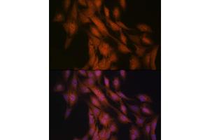 Immunofluorescence analysis of C6 cells using Gli3 Rabbit mAb (ABIN7267385) at dilution of 1:100 (40x lens). (GLI3 anticorps)
