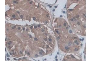 Detection of CD209 in Human Stomach Tissue using Polyclonal Antibody to Cluster Of Differentiation 209 (CD209)