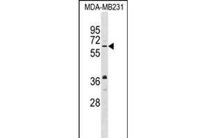NELF Antibody (C-term) (ABIN1537414 and ABIN2848924) western blot analysis in MDA-M cell line lysates (35 μg/lane). (NMDA Receptor Synaptonuclear Signaling and Neuronal Migration Factor (NSMF) (AA 501-530), (C-Term) anticorps)
