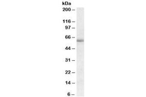 Western blot testing of human amygdala lysate with Cadherin 23 antibody at 1ug/ml. (CDH23 anticorps)