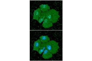 ICC/IF analysis of PDPN in Hep3B cells line, stained with DAPI (Blue) for nucleus staining and monoclonal anti-human PDPN antibody (1:100) with goat anti-mouse IgG-Alexa fluor 488 conjugate (Green).