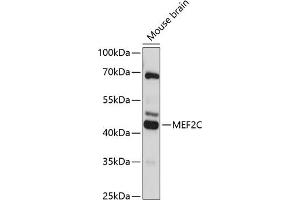 Western blot analysis of extracts of mouse brain, using MEF2C antibody (ABIN6132345, ABIN6143716, ABIN6143717 and ABIN6215998) at 1:3000 dilution. (MEF2C anticorps  (AA 170-380))