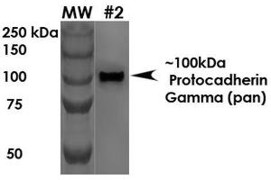 Western Blot analysis of Rat Brain Membrane showing detection of ~100 kDa Protocadherin Gamma protein using Mouse Anti-Protocadherin Gamma Monoclonal Antibody, Clone S159-5 . (Protocadherin gamma anticorps  (AA 808-931) (APC))